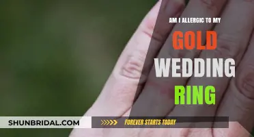 Gold Wedding Ring Allergies: What You Need to Know