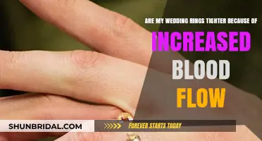 Why Do Wedding Rings Feel Tighter with Increased Blood Flow?