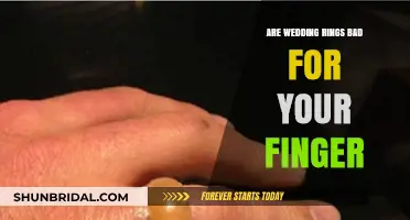 Wedding Rings: Finger Health Risks?