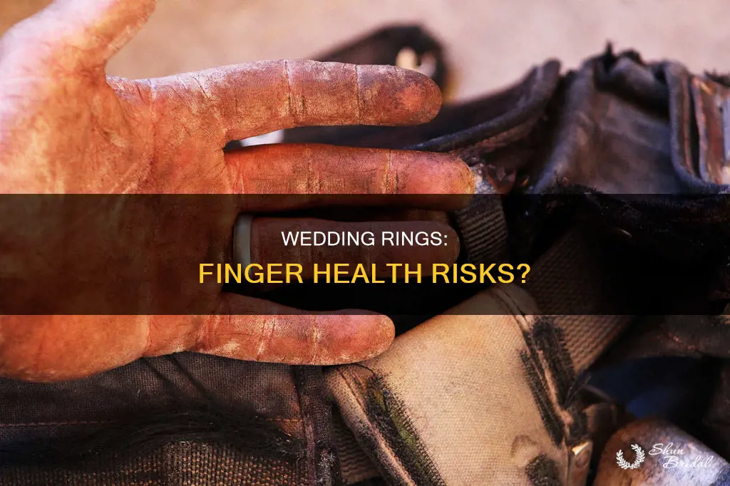 are wedding rings bad for your finger