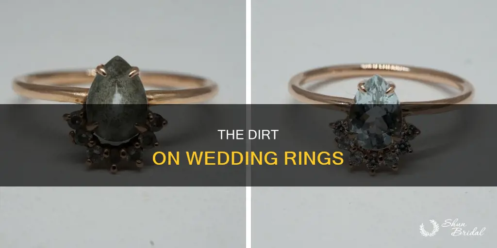 are wedding rings super dirty
