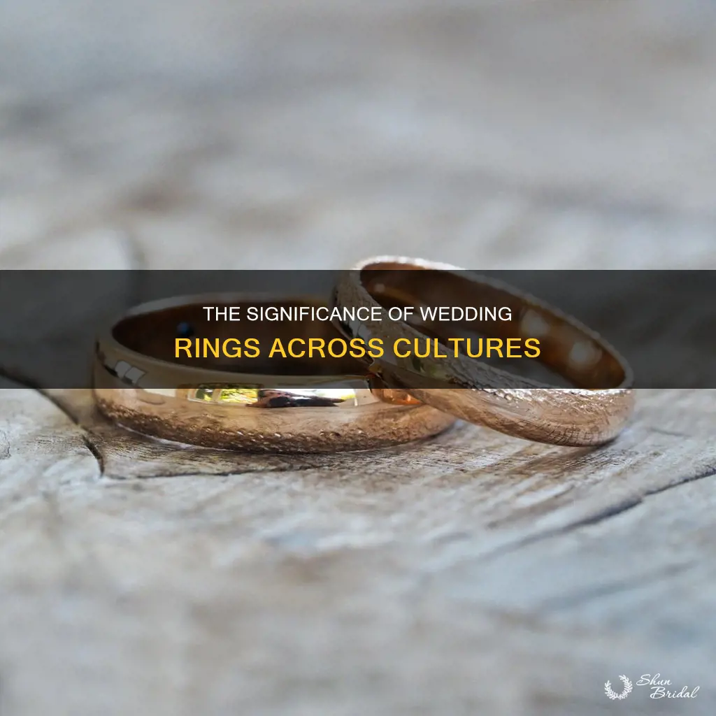 are wedding rings universal