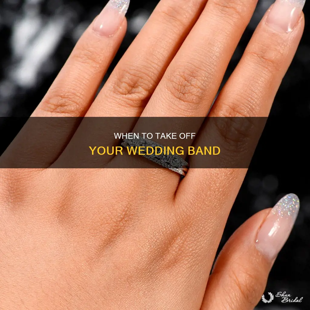 are you supposed to take off wedding band