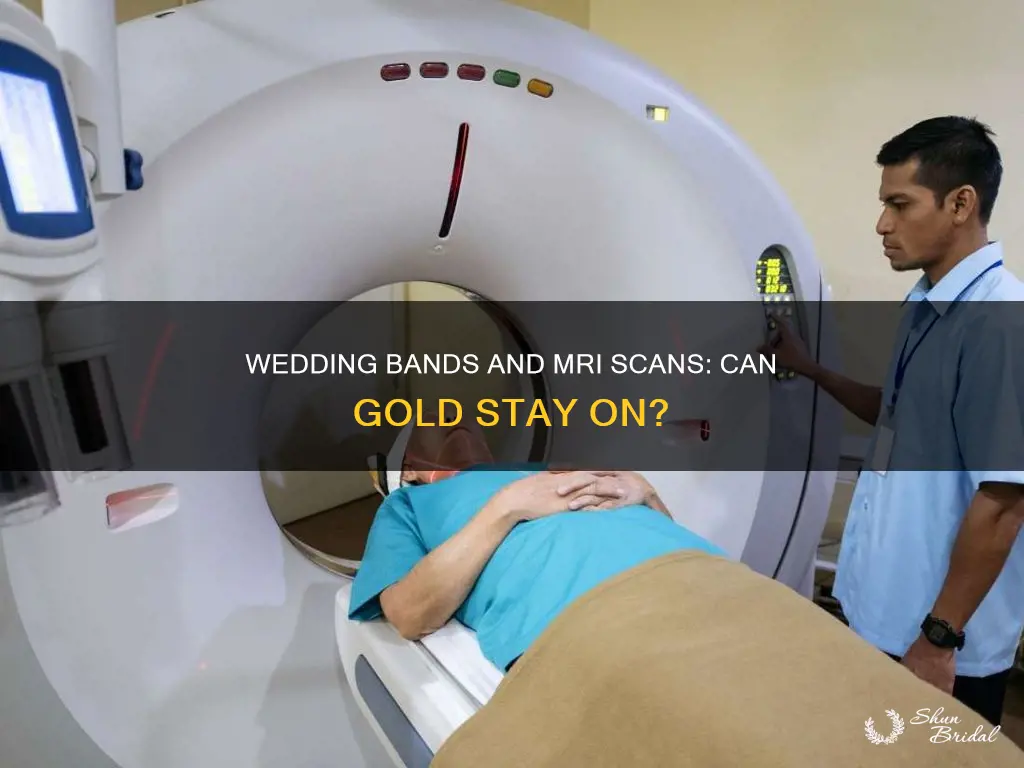 can a gold wedding band be worn during an mri