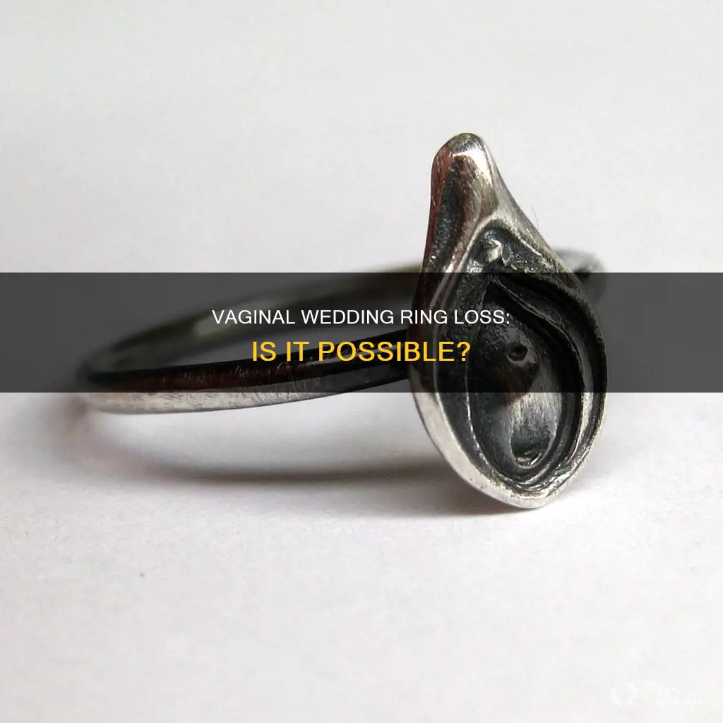 can a wedding ring get lost in a vagina