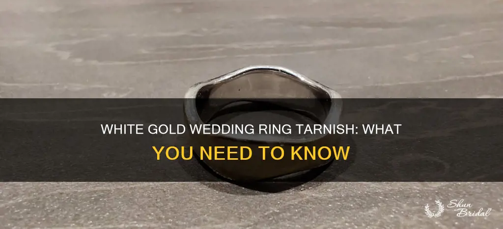 can a white gold wedding ring tarnish