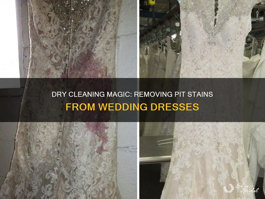 can dry cleaners remove pit stains from wedding dress