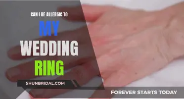 Wedding Ring Allergies: Is Your Finger Trying to Tell You Something?