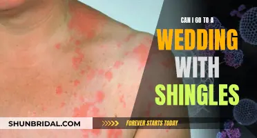 Shingles and Weddings: Should You Attend?