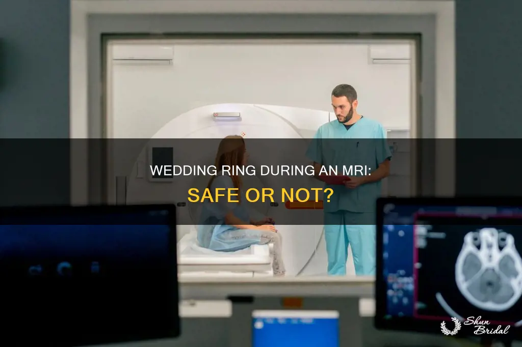 can I keep my wedding ring on during an mri