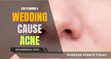 Stress of Wedding Planning: Can it Cause Acne?