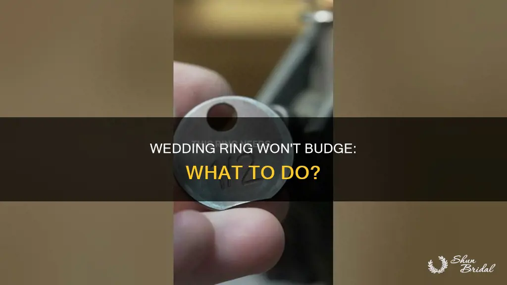 can t get my wedding ring off