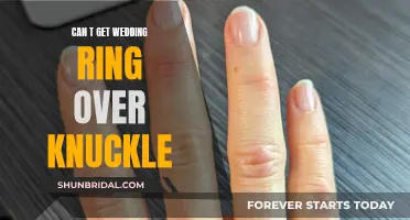 Wedding Ring Stuck? Tips to Get it Over the Knuckle