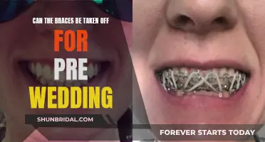 Braces-Free Smile for Your Pre-Wedding Photos