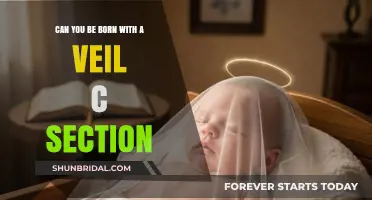 Born with a Veil: C-Section and the Myth Explained