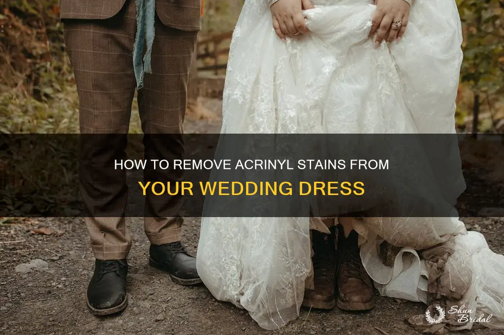 can you take acrinlin out your wedding dress