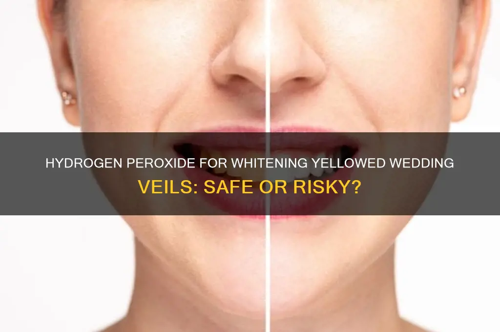 can you use hydrogen peroxide to whiten yellowed wedding veil