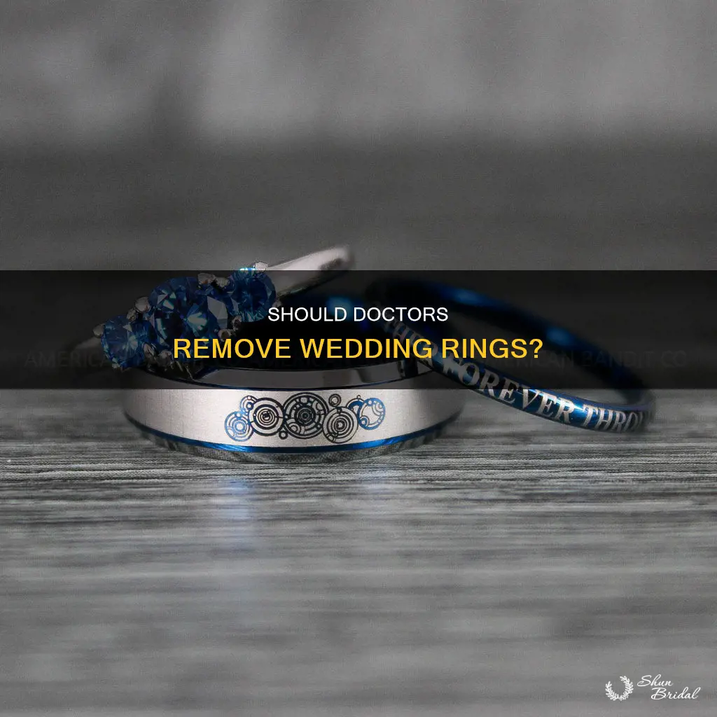do doctors remove wedding rings of patients