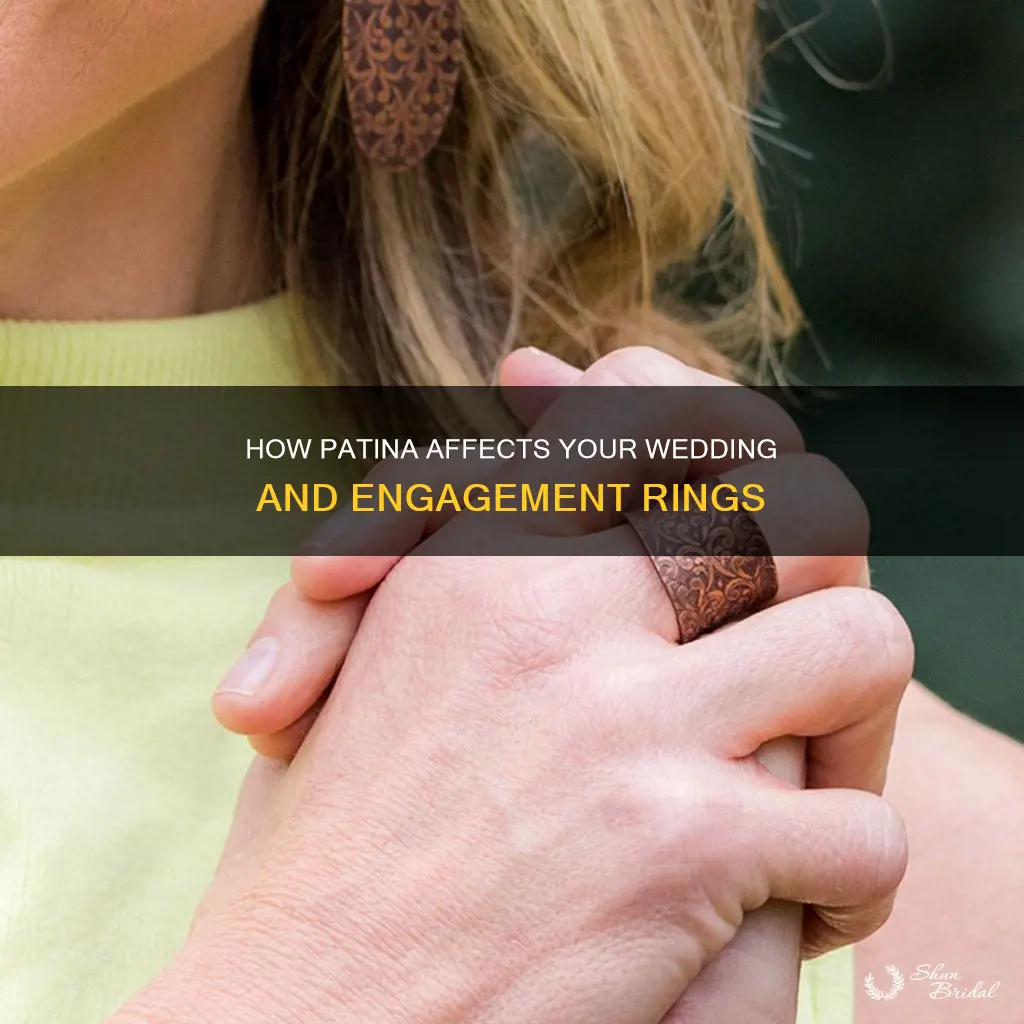 do engagement or wedding rings patina