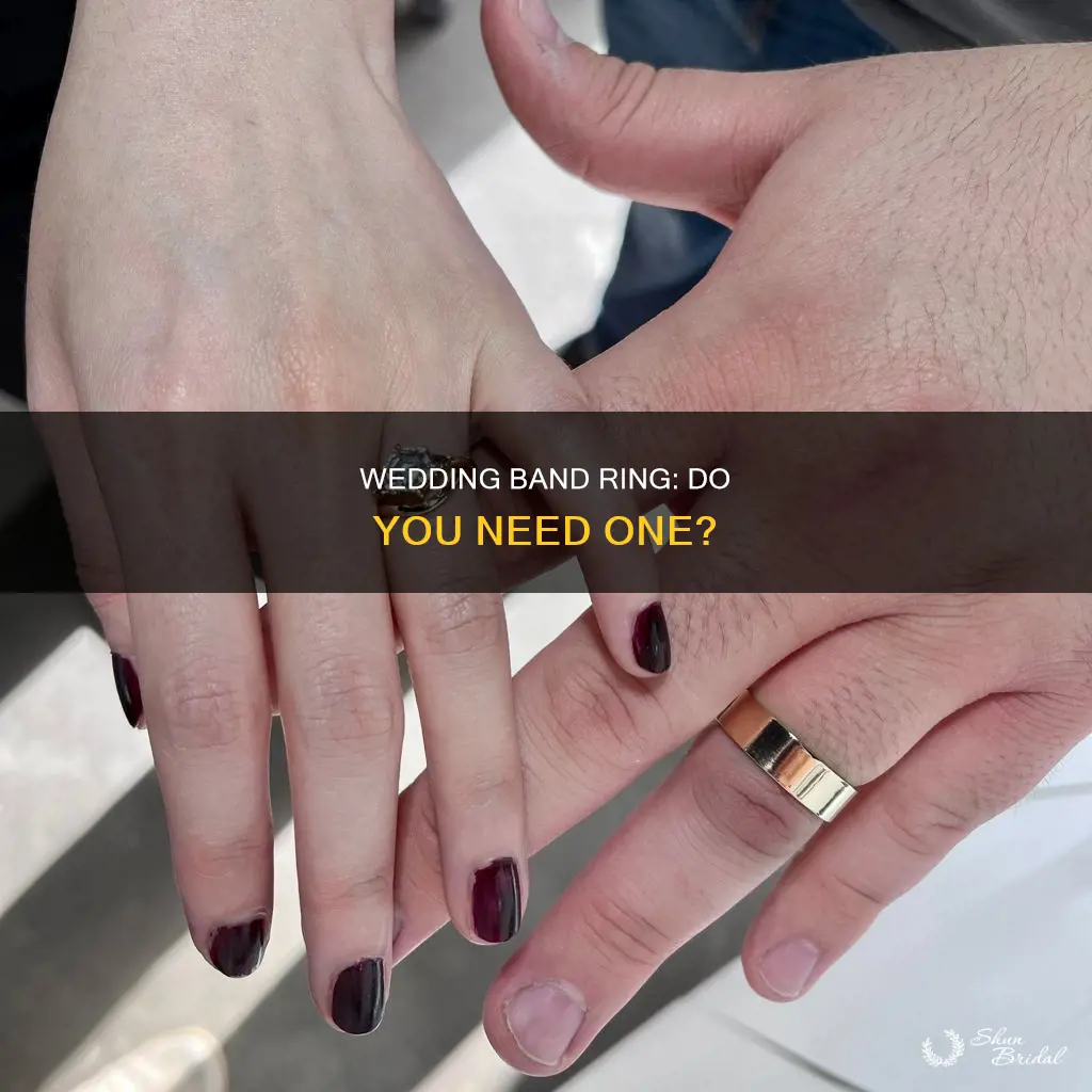 do I need a wedding band ring