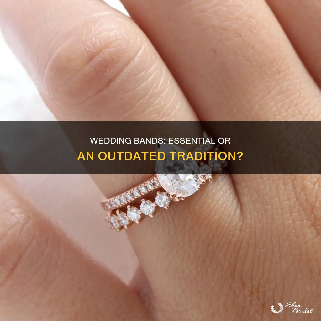 do I need a wedding band