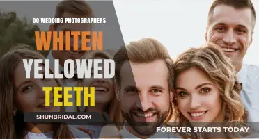 Wedding Photographers: Whiten Yellow Teeth?