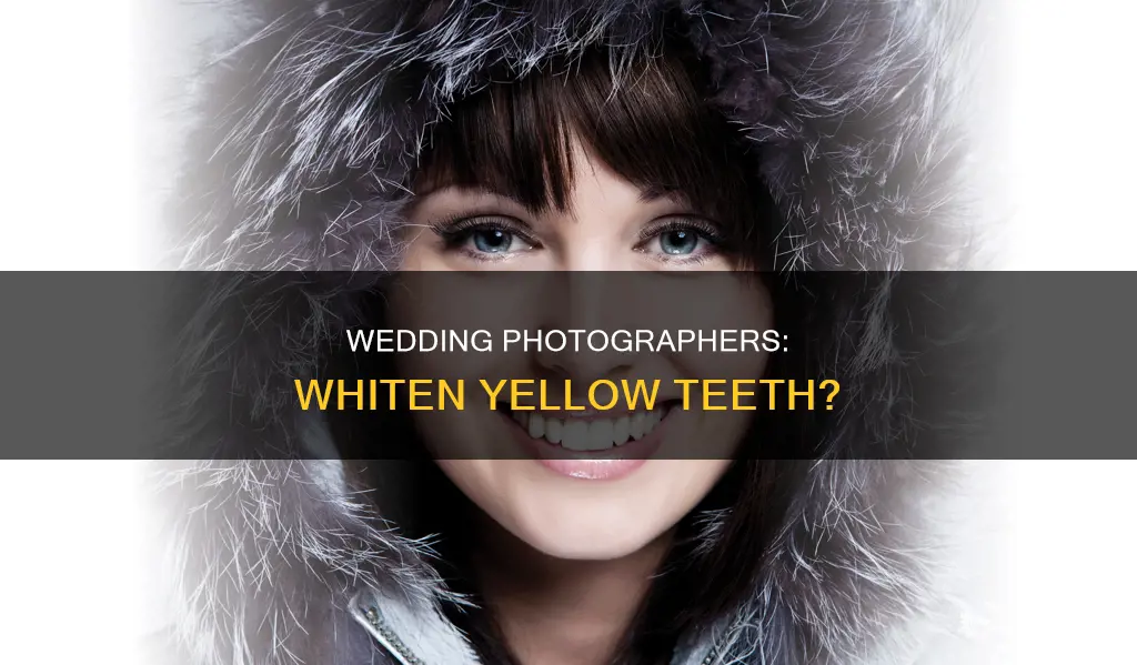 do wedding photographers whiten yellowed teeth