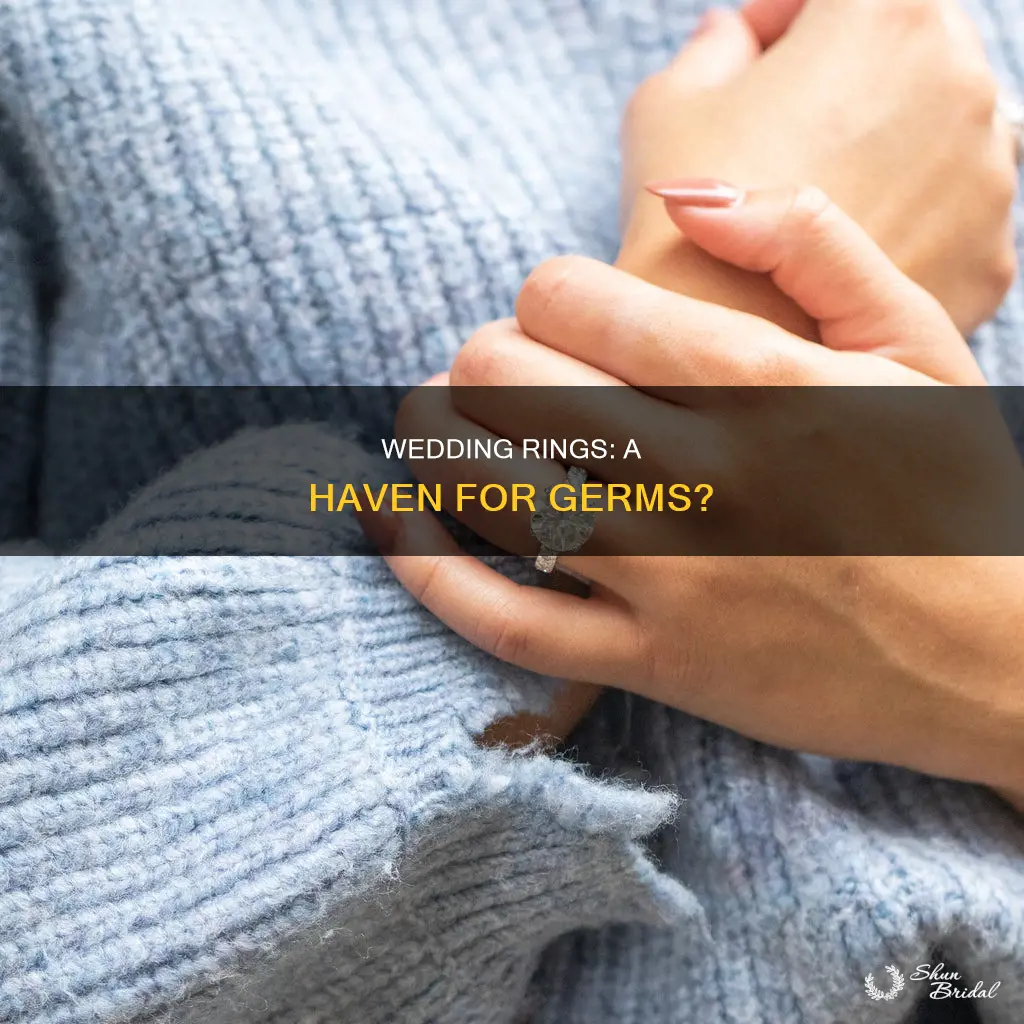 do wedding rings have a lot of germs