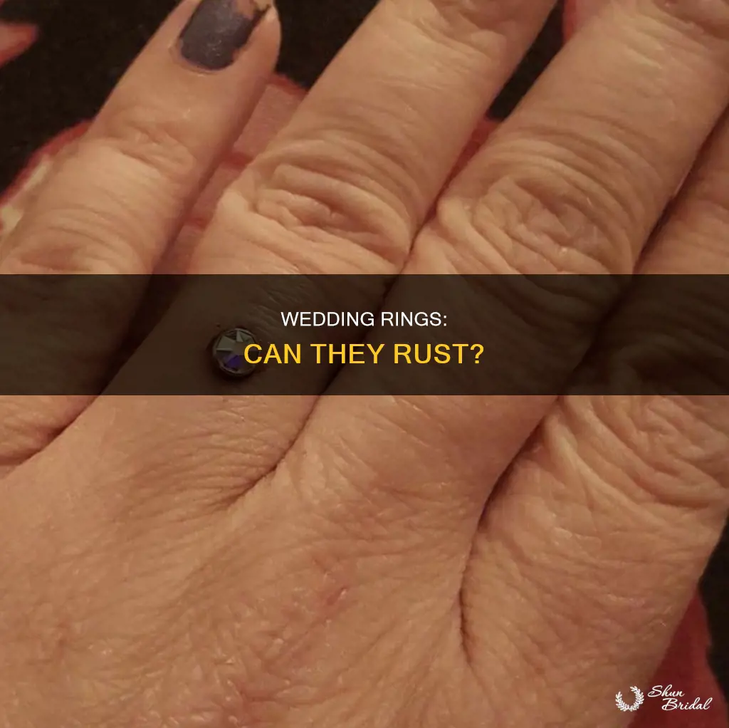 do wedding rings rush if you never take it off