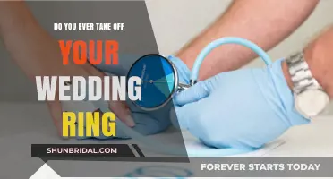 The Wedding Ring: When to Take It Off