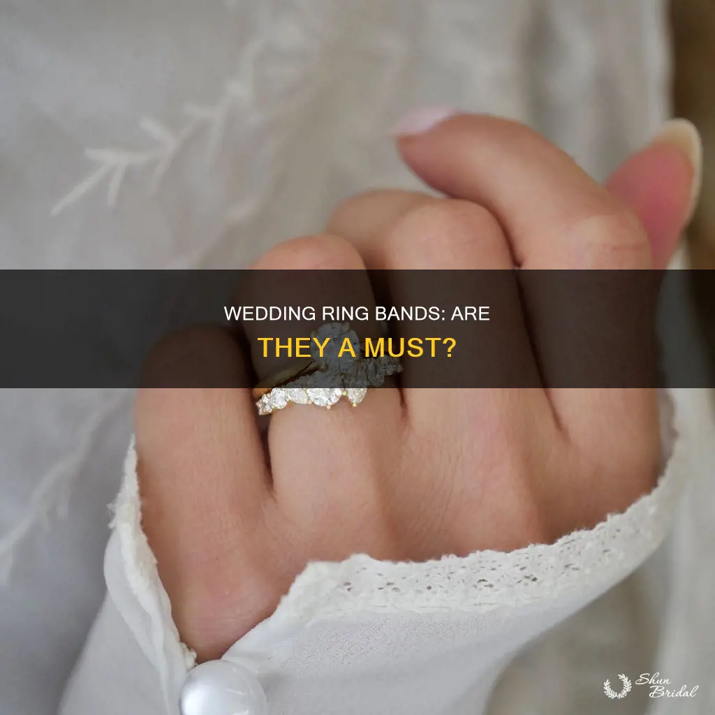 do you have to have a band on wedding ring