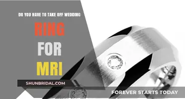 MRI Scans: Keep Your Wedding Ring On or Off?