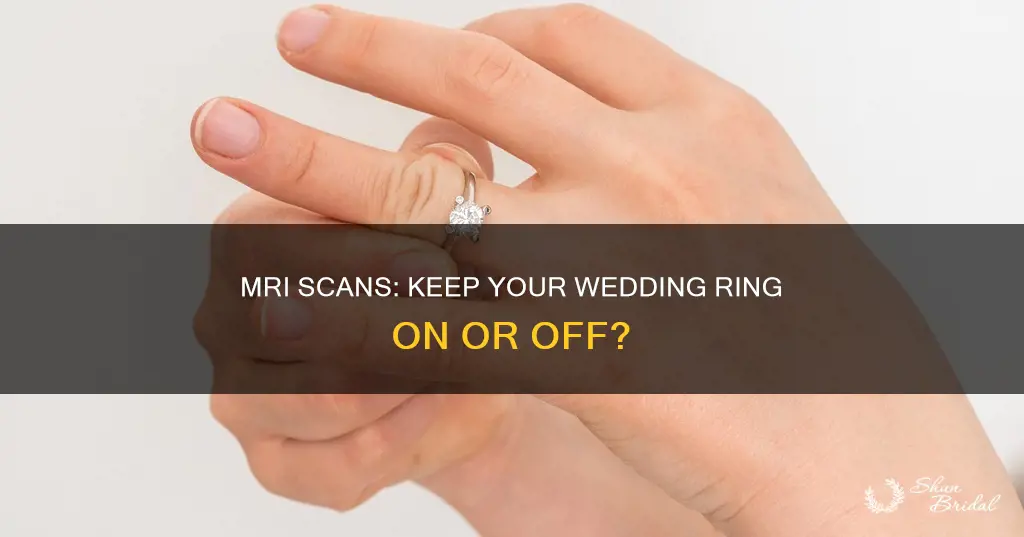 do you have to take off wedding ring for mri