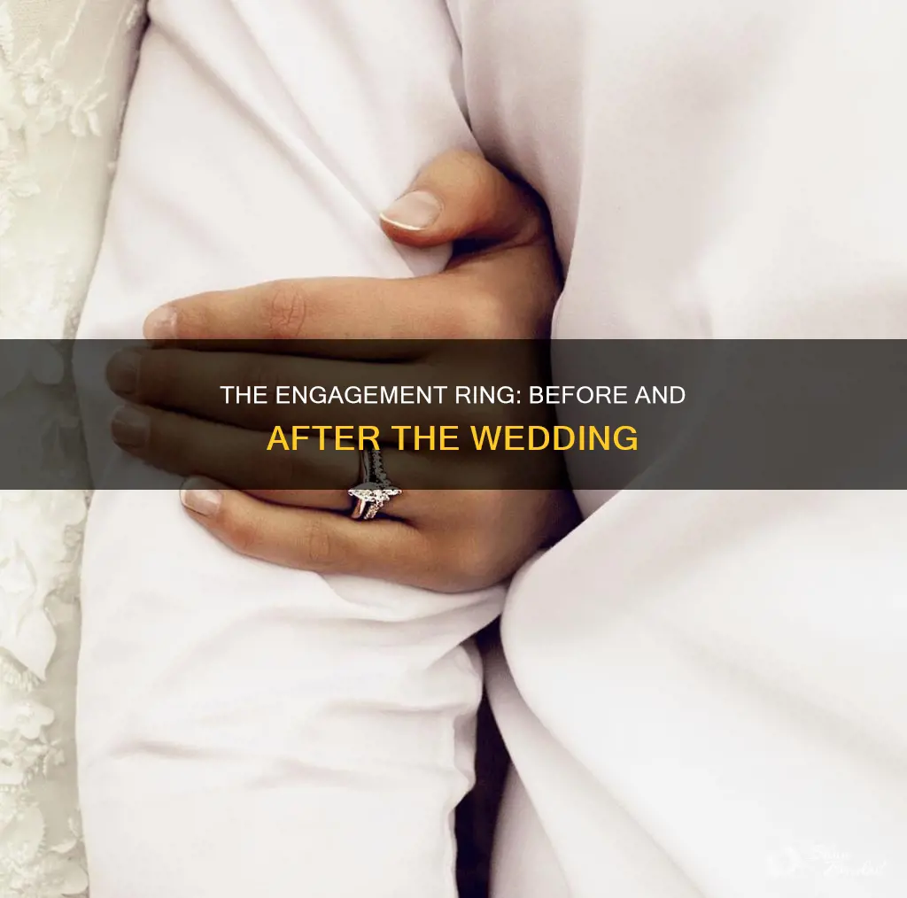 do you keep an engagement ring after wedding