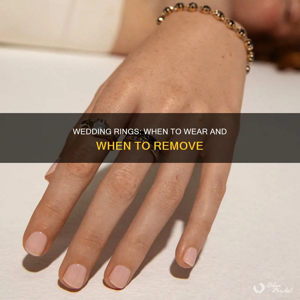 do you keep your wedding ring on all the time