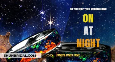 Should You Keep Your Wedding Ring on at Night?
