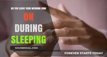 Should You Sleep with Your Wedding Ring On?