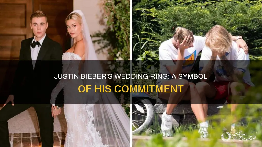 does justin bieber wedding ring