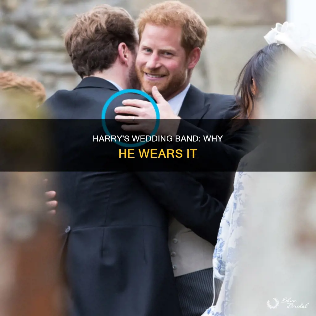 does prince harry have a wedding band