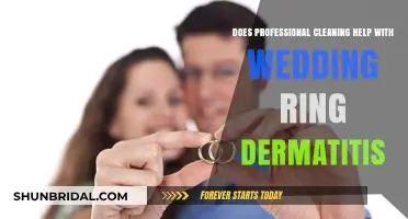 Wedding Ring Dermatitis: Can Professional Cleaning Help?