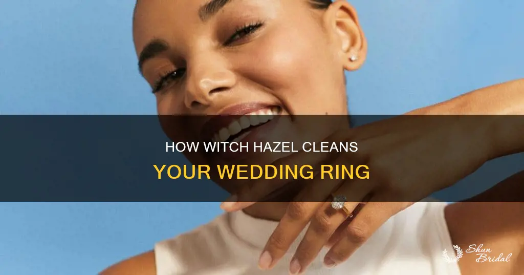 does witch hazel clean wedding rings