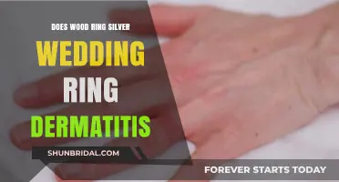 Wood Rings: A Safe Silver Wedding Ring Alternative