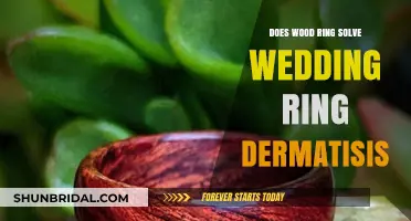 Wood Rings: A Comfortable Solution for Wedding Ring Dermatitis