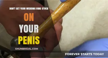 A Risky Romance: Wedding Ring Stuck on Penis