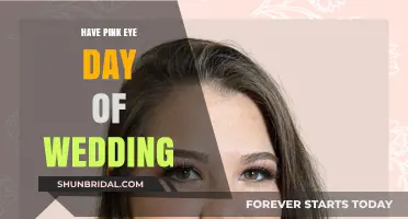 Pink Eye on Your Wedding Day: Quick Fixes and Solutions