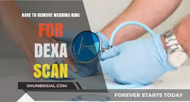 Wedding Ring Removal for Dexa Scan: Necessary?