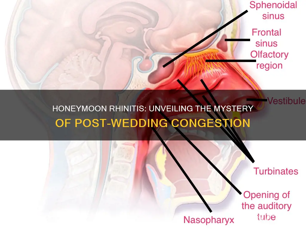 how common is honeymoon rhinitis