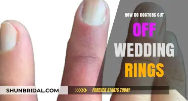 Removing Wedding Rings: Medical Techniques and Tools
