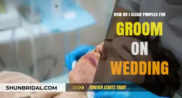 Groom's Guide: Clear Pimples Fast for Your Wedding Day