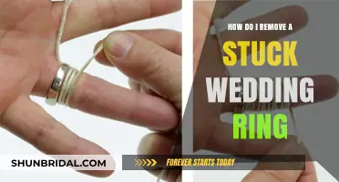Remove a Stuck Wedding Ring: Quick and Safe Methods
